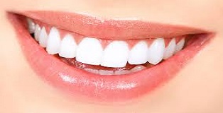 Bella teeth - efectos secundarios contraindicaciones-para hace mal