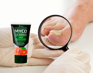 Mycodermin crema, ingredientes, cómo aplicar, como funciona, efectos secundarios
